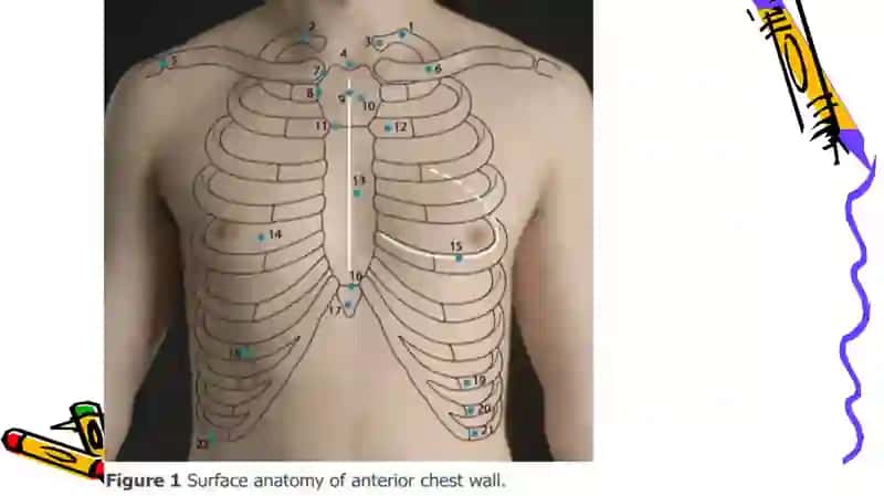THE chest 4