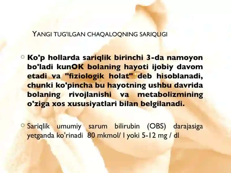 Sariqlik yangi tug'ilgan chaqaloqlar 4