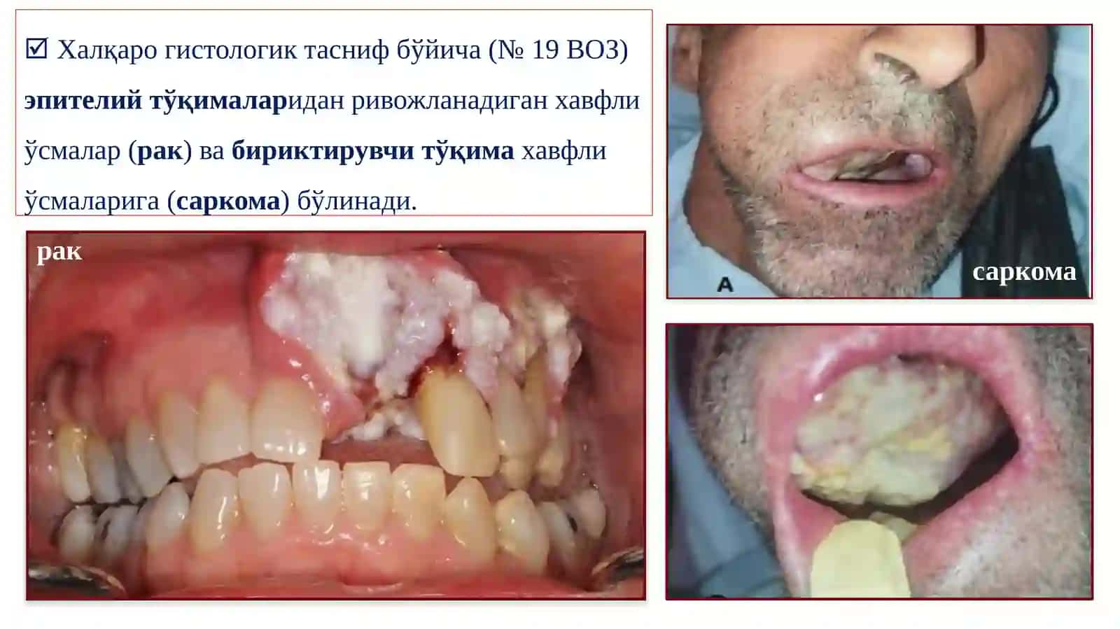 ЮҚОРИ ВА ПАСТКИ ЖАҒ ХАВФЛИ ЎСМАЛАРИ 4