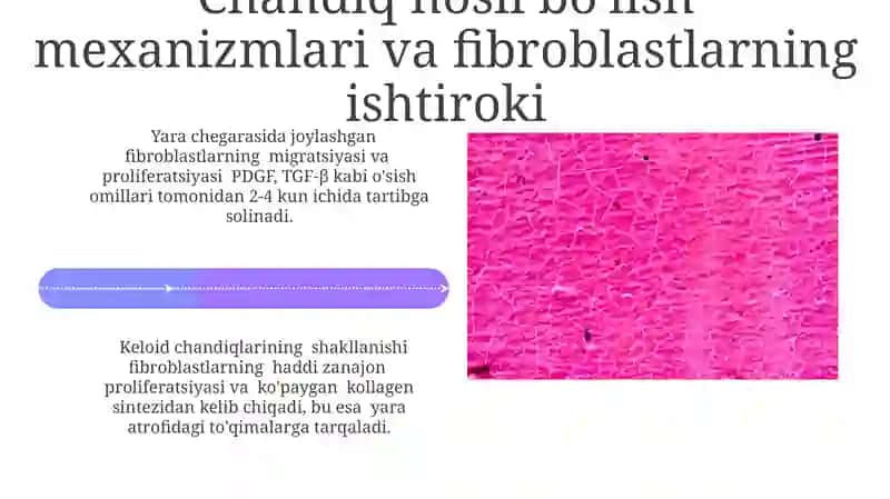 Fibroblastlarning jarohatning bitishi va chandiq hosil boʻlishidagi roli 4