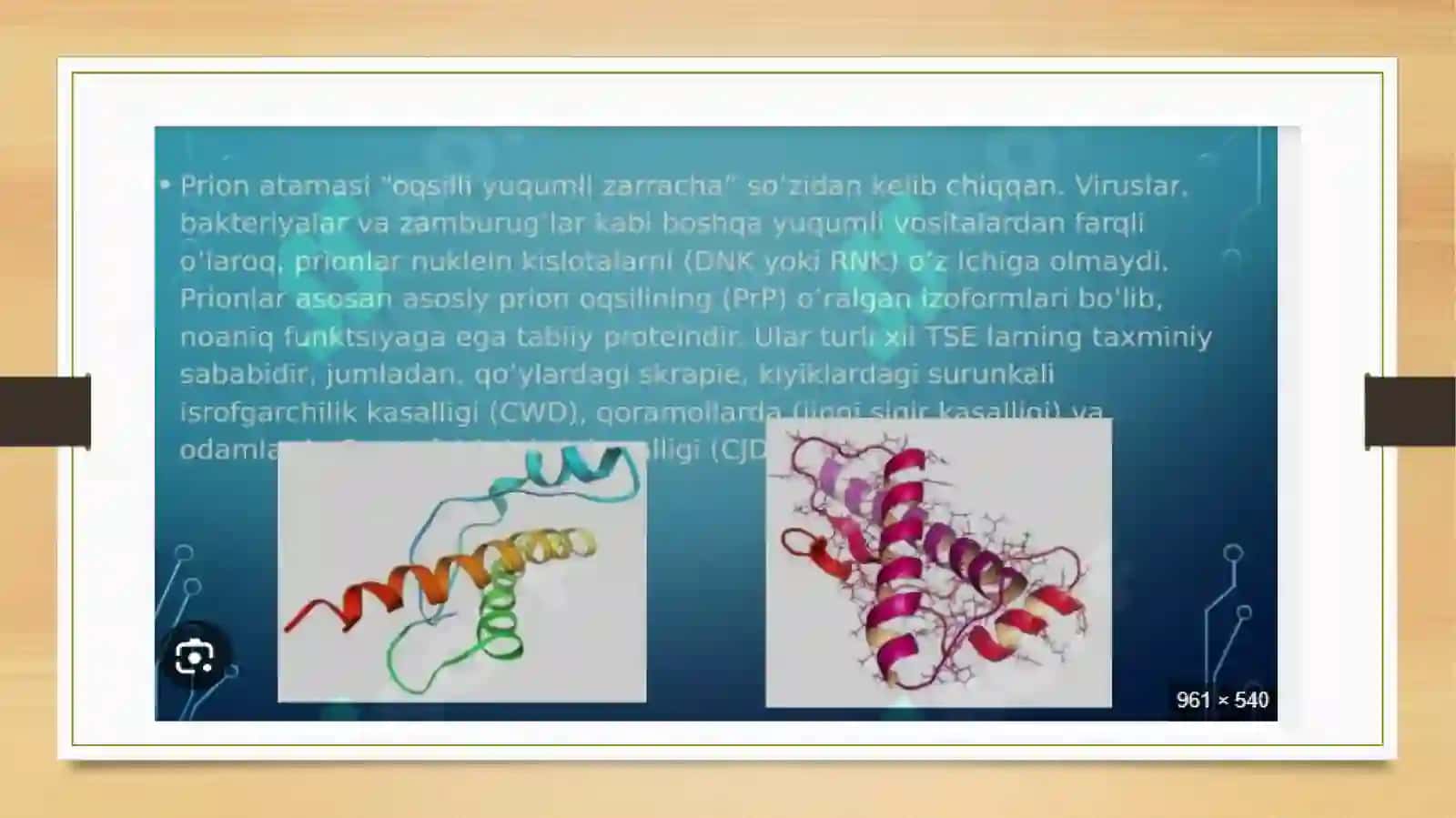 Prion kasalliklari 4