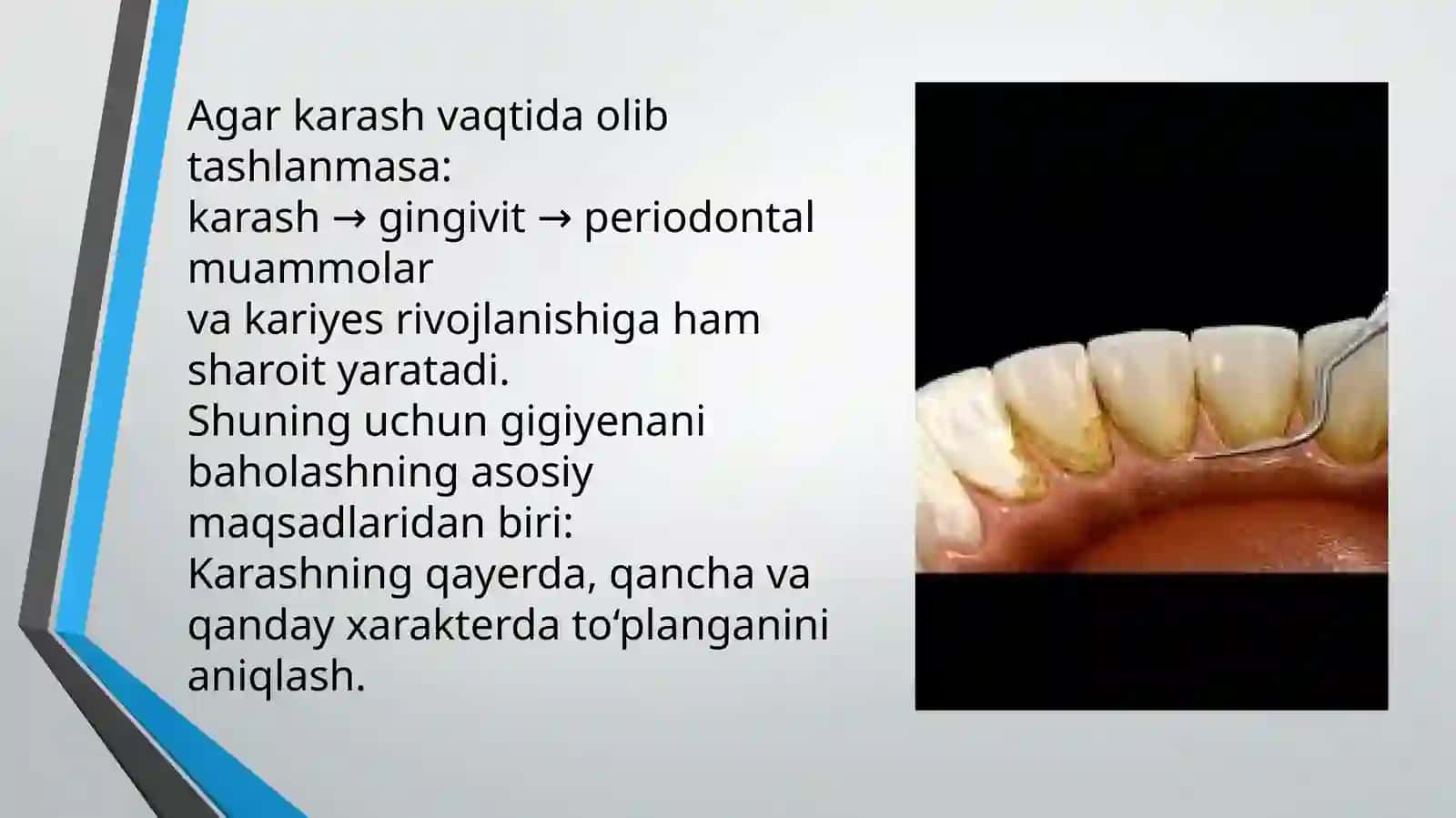 Stomatologik gigiyena 4