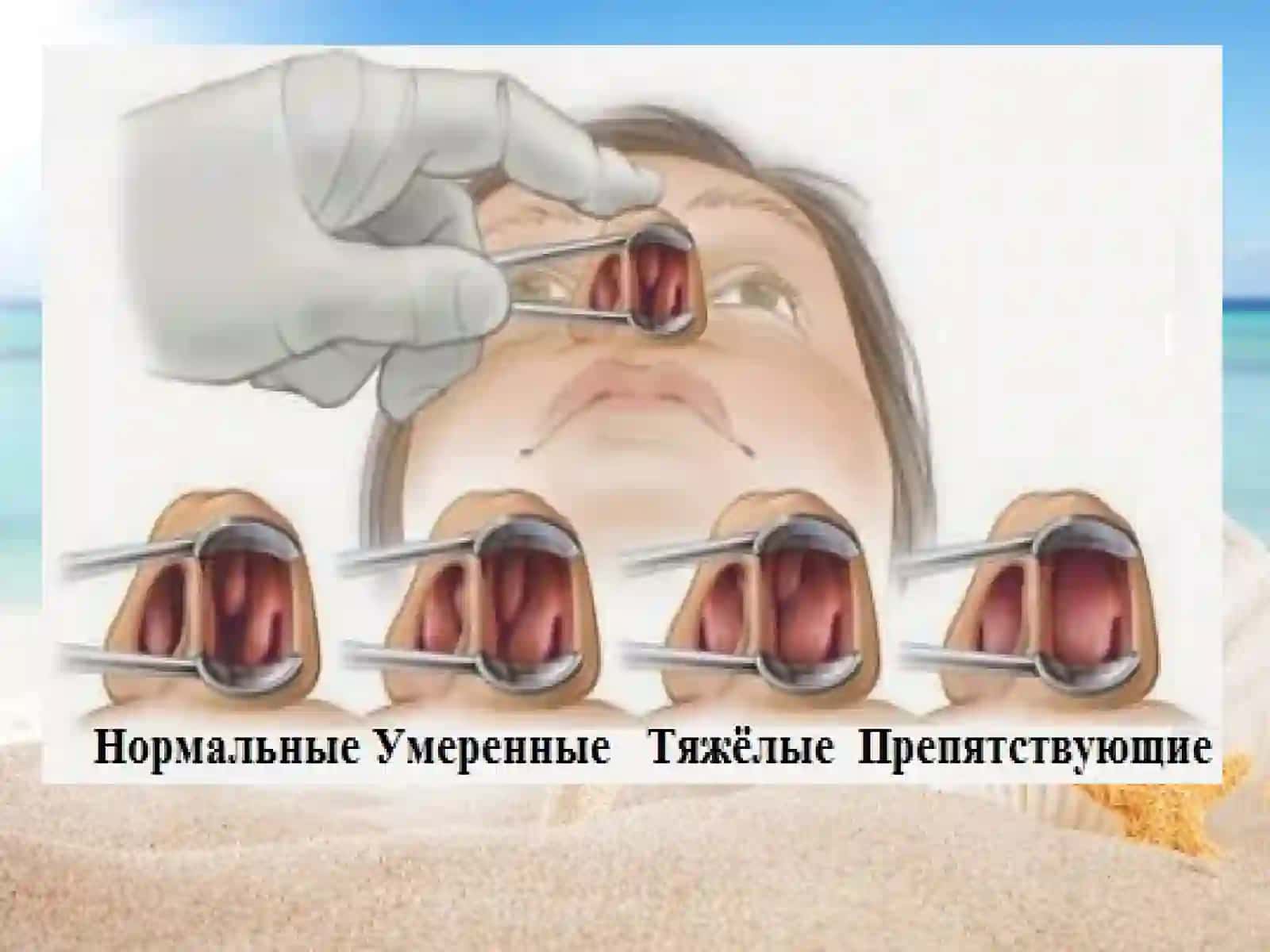 Nafasaʼzolarionto-filogenezivaanomaliyasi 4
