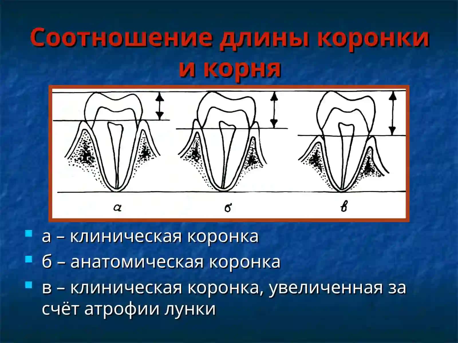 Строение зубных рядов, Окклюзия, Артикуляция. Виды прикусов 4