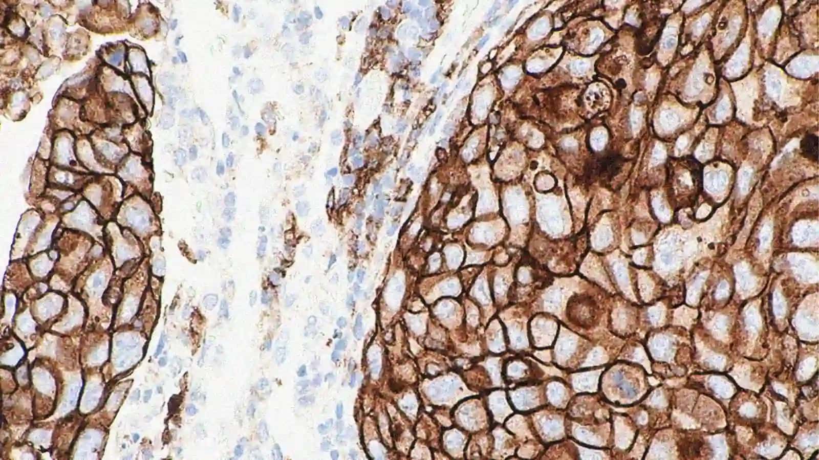 Onkologik va yurak-qon tomir kasalliklarining epidemiologiyasi va profilaktikasi 4