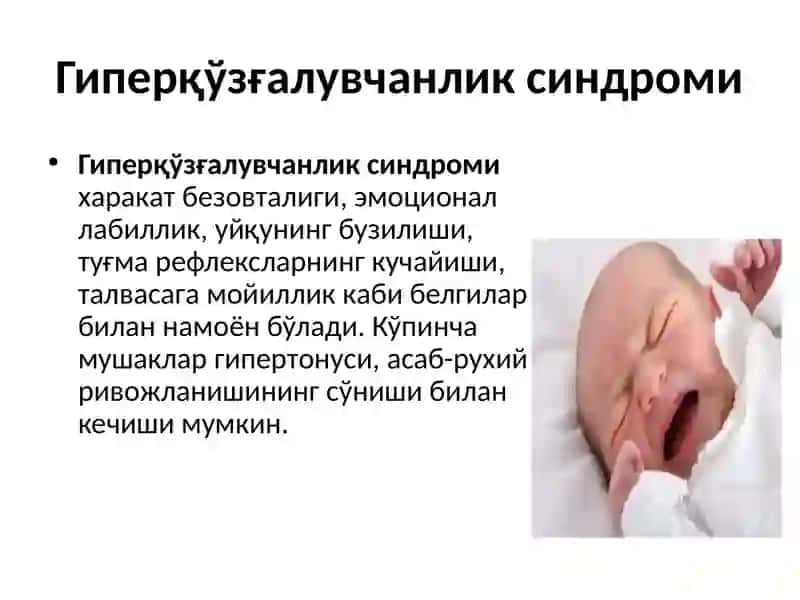 Кам қўзғалувчанлик синдроми 4