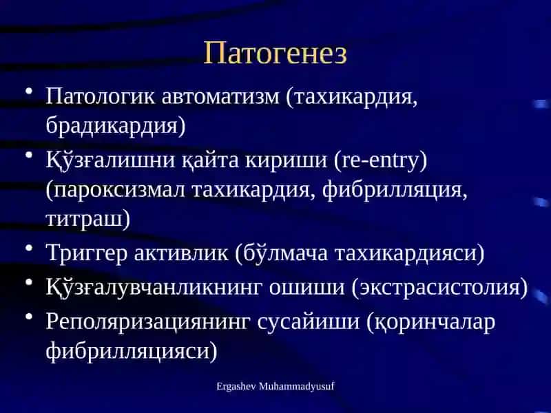 Аритмия 4