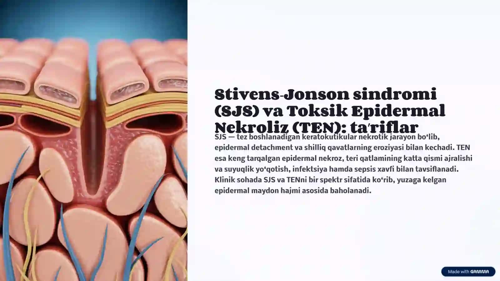 Leyella va Stiven Jonson sindromi 4