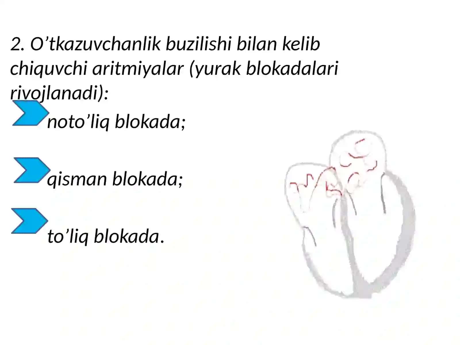 ARITMIYALAR 4