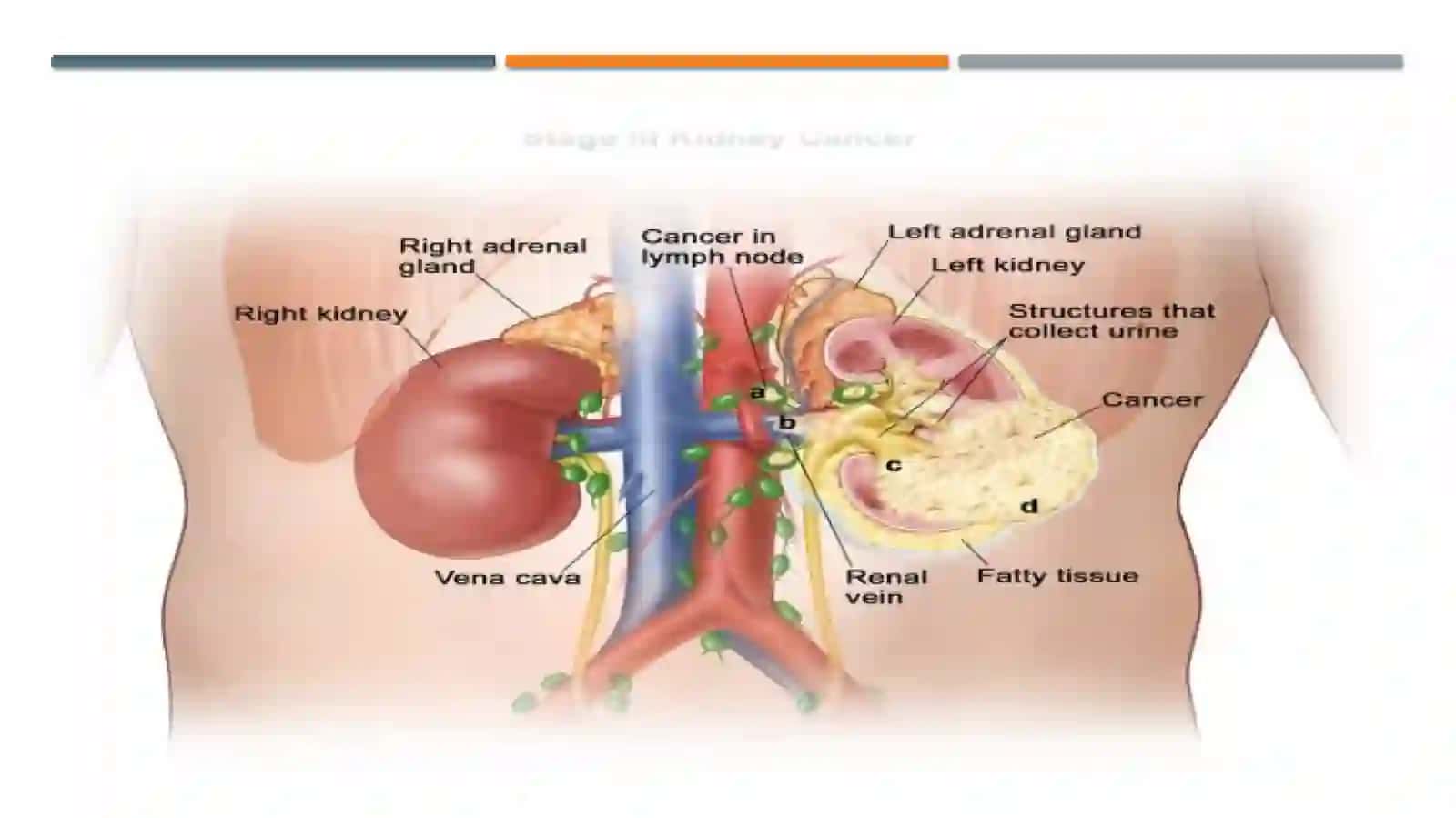 UROLOGIK O‘SMALAR 4