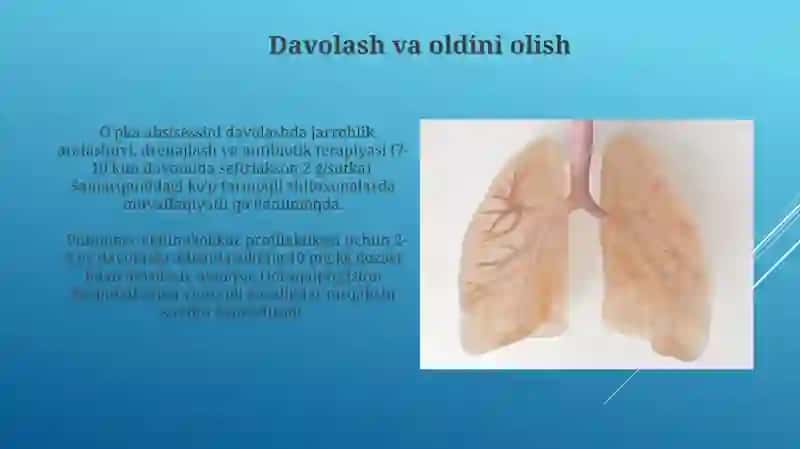 Pnevmoniya etiologiyasi, klassifikatsiyasi 4
