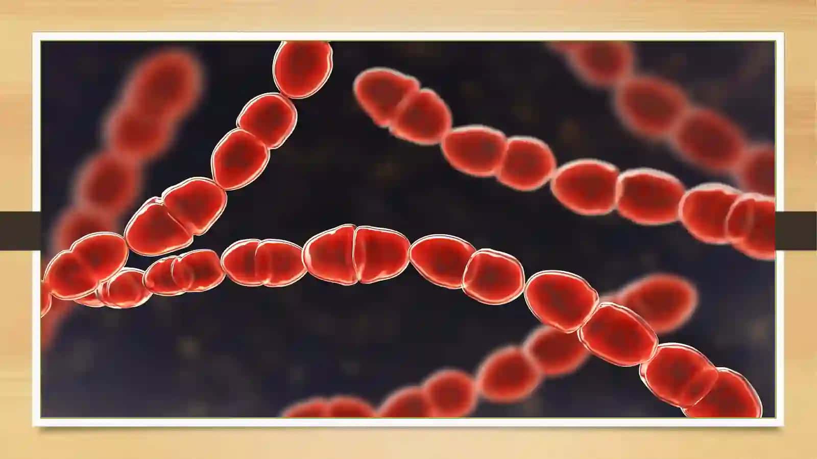 Shartli patogen anaerob kokklar(peptokkoklar,peptostreptokokklar,veylonellalar)ularni xirurgikvaginekologikkasalliklargaahamiyati 4