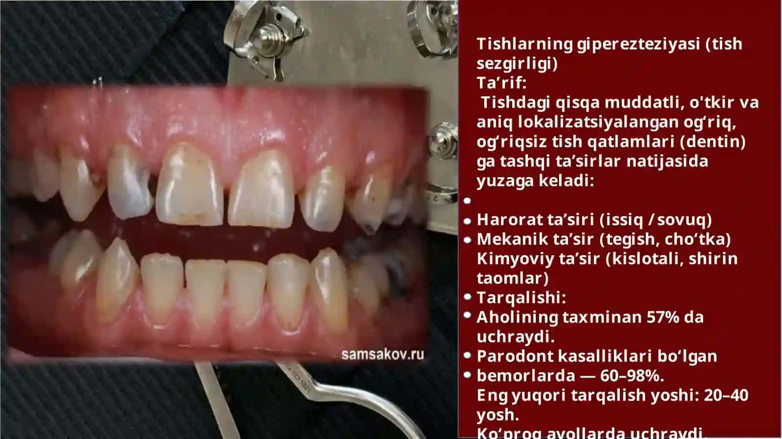 Tashqi va ichki salbiy ta'sir tomonidan to'g'ri 4