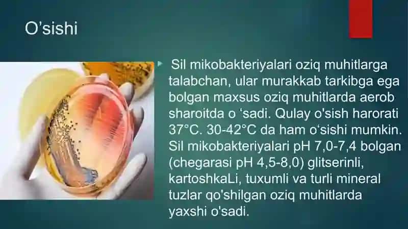 SIL kasalligi 4