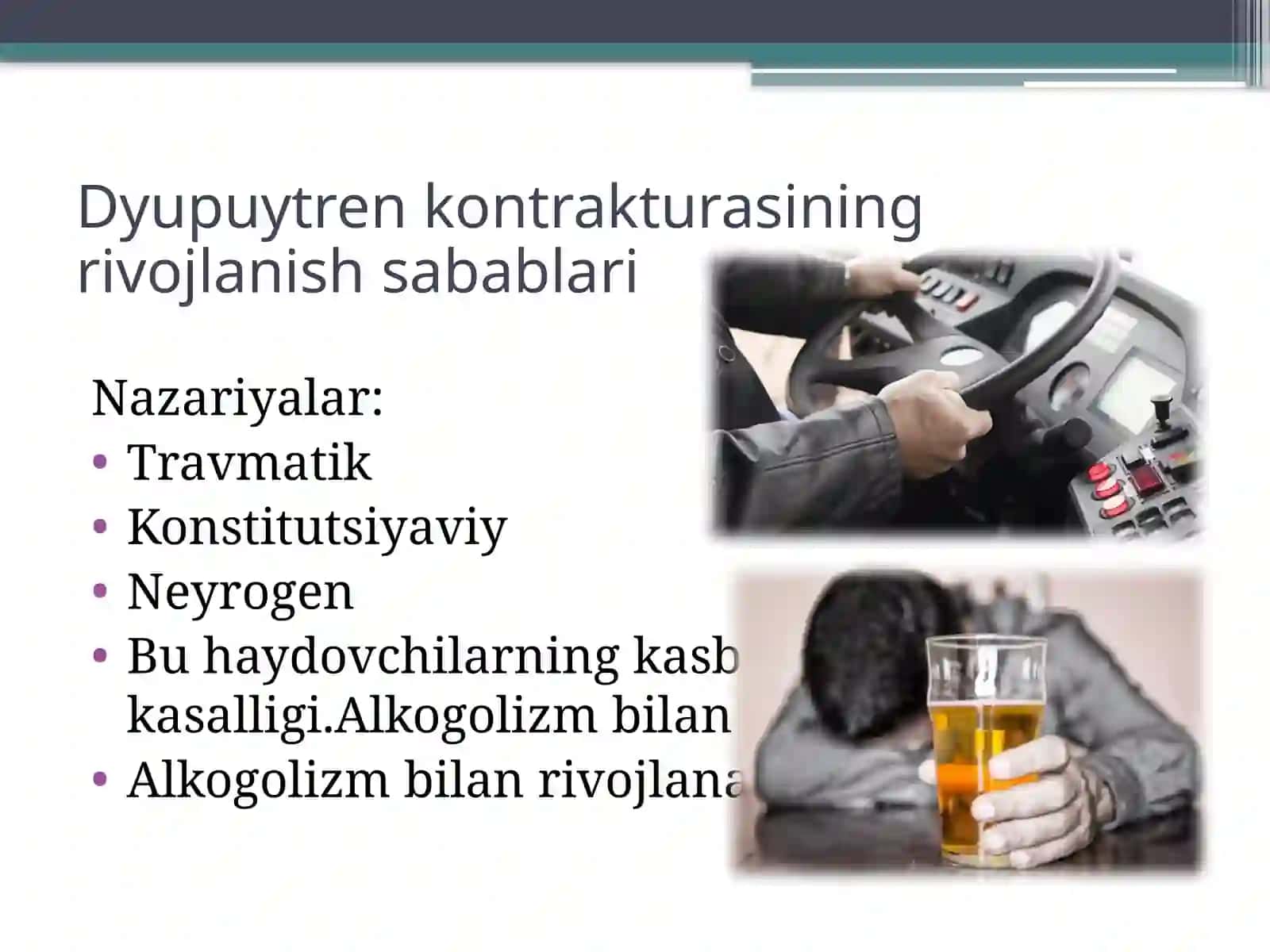 Dyupyuitren kontrakturasi 4