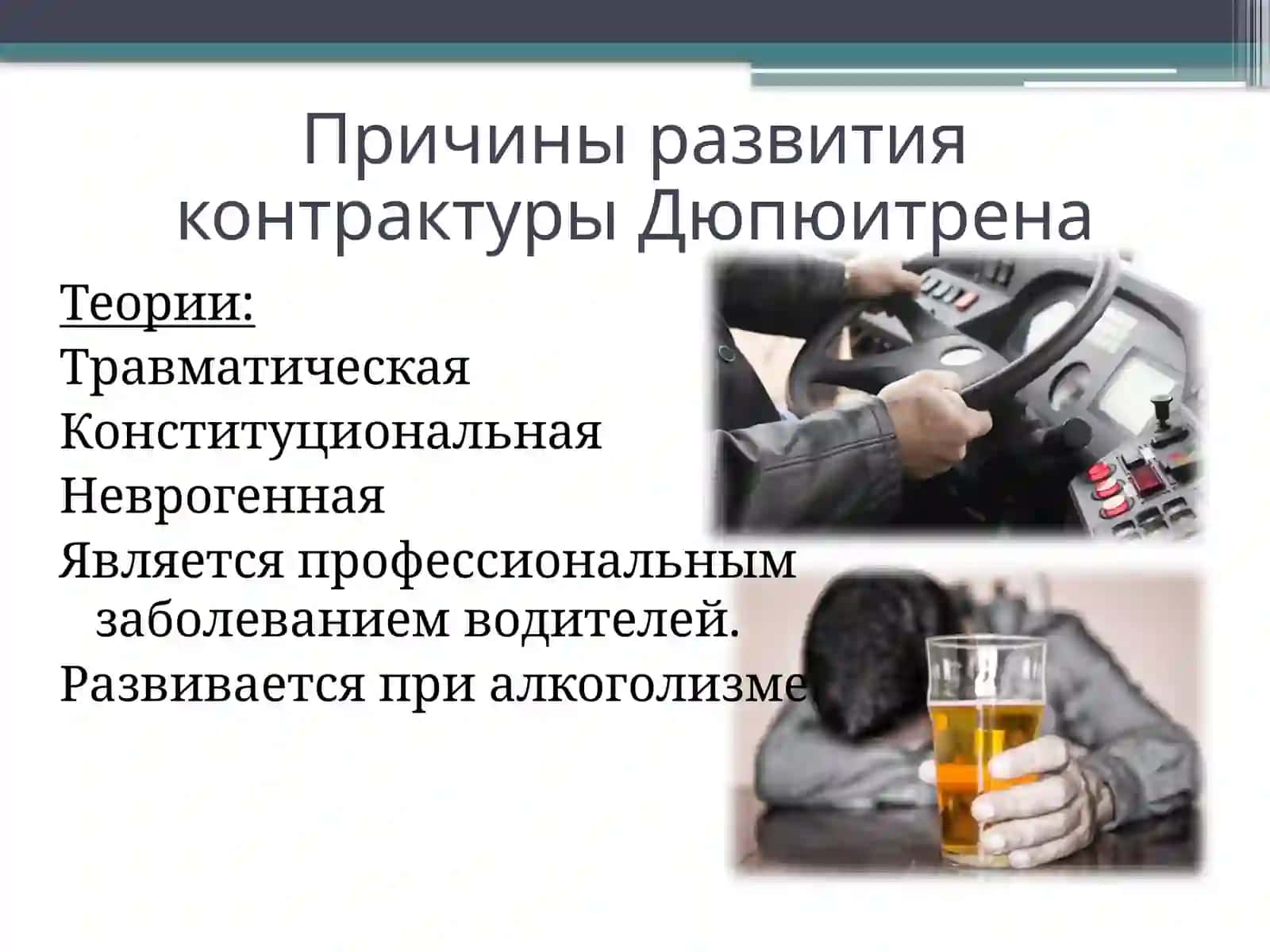 КОНТРАКТУРА ДЮПЮИТРЕНА. ЛЕЧЕНИЕ КОЛЛАГЕНАЗОЙ 4
