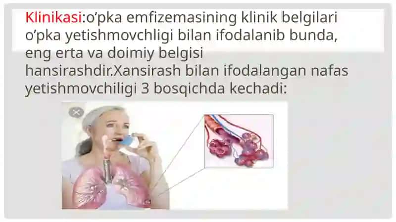O’PKAEMFIZEMASI 4