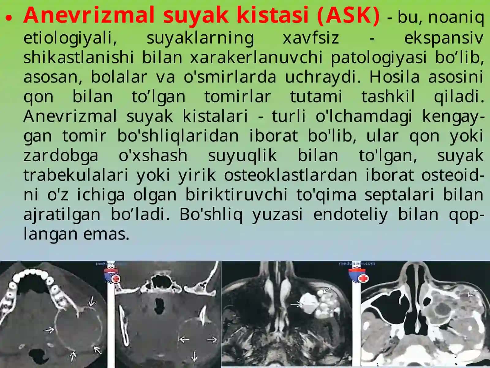 yuz jag‘ sohasi o‘smalari 4