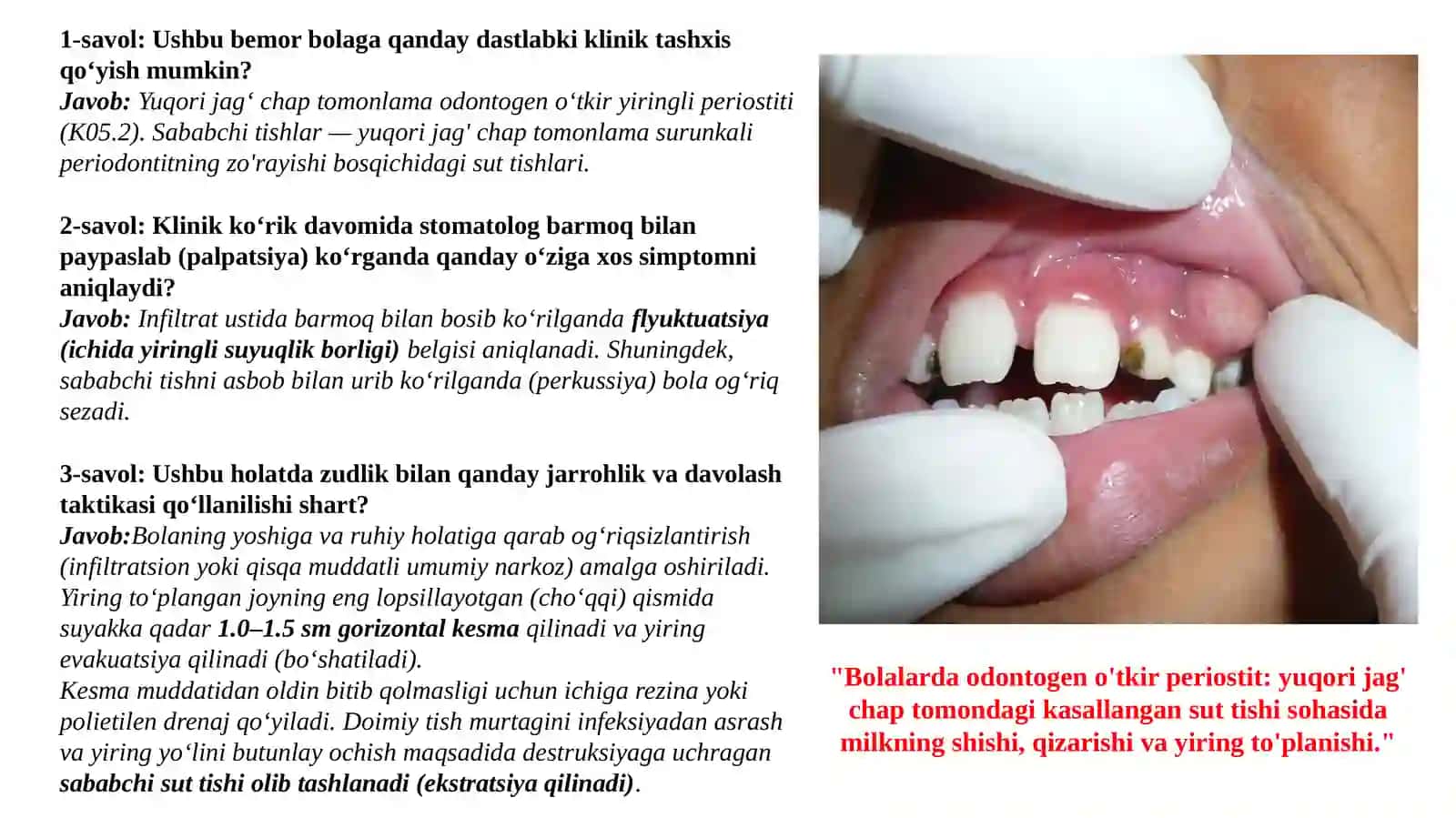 Bolalar Jag' Suyagining O'tkir va Surunkali Periostiti 4