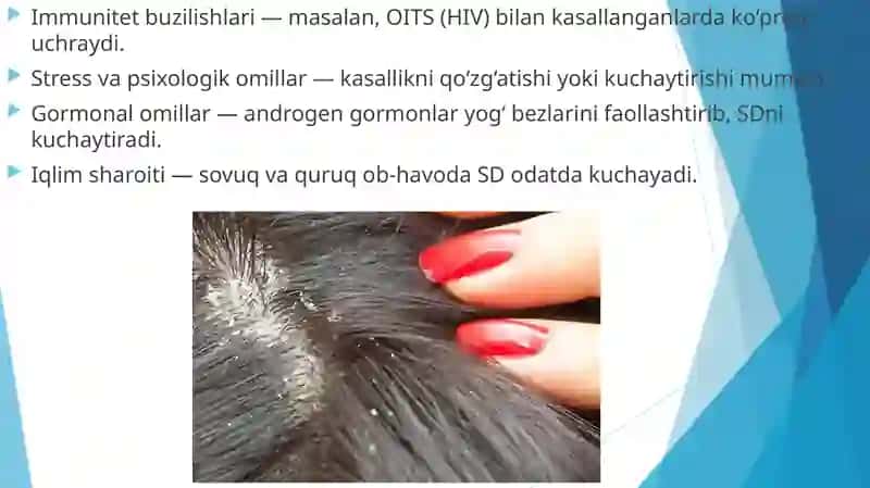 Seboreya dermatit va pushti rang husunbuzar 4