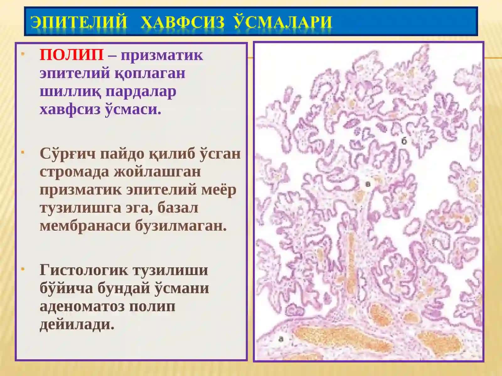Ўсмалар. Мезенхимал ўсмалар 4