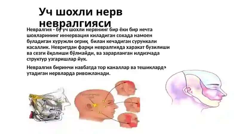 Учшохли нерв 4