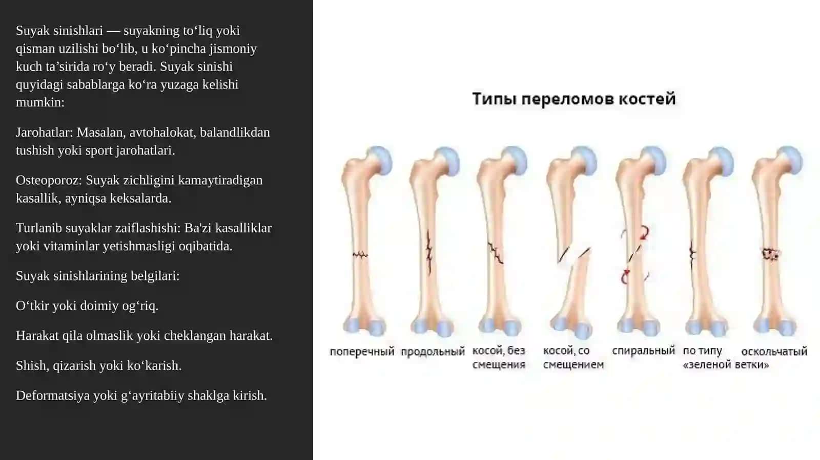 Suyak rivojlanishining buzilishlari. Sinishlar. Osteonekrozlar 4