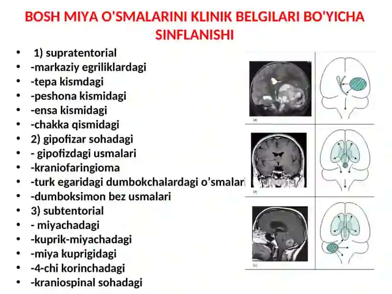 BOSH VA ORQA MIYA O'SMALARI 4