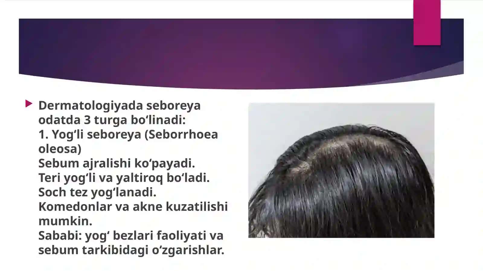 Seboreya va uning tasnifi 4