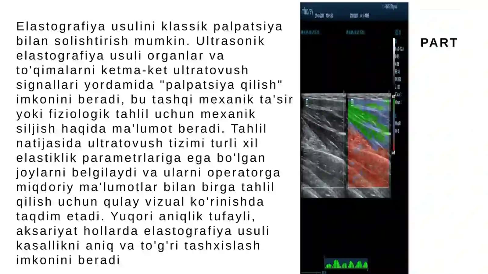 Elastografiya tekshirish usuli 4