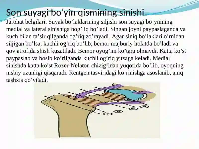 Sonsuyagining sinishlari 4