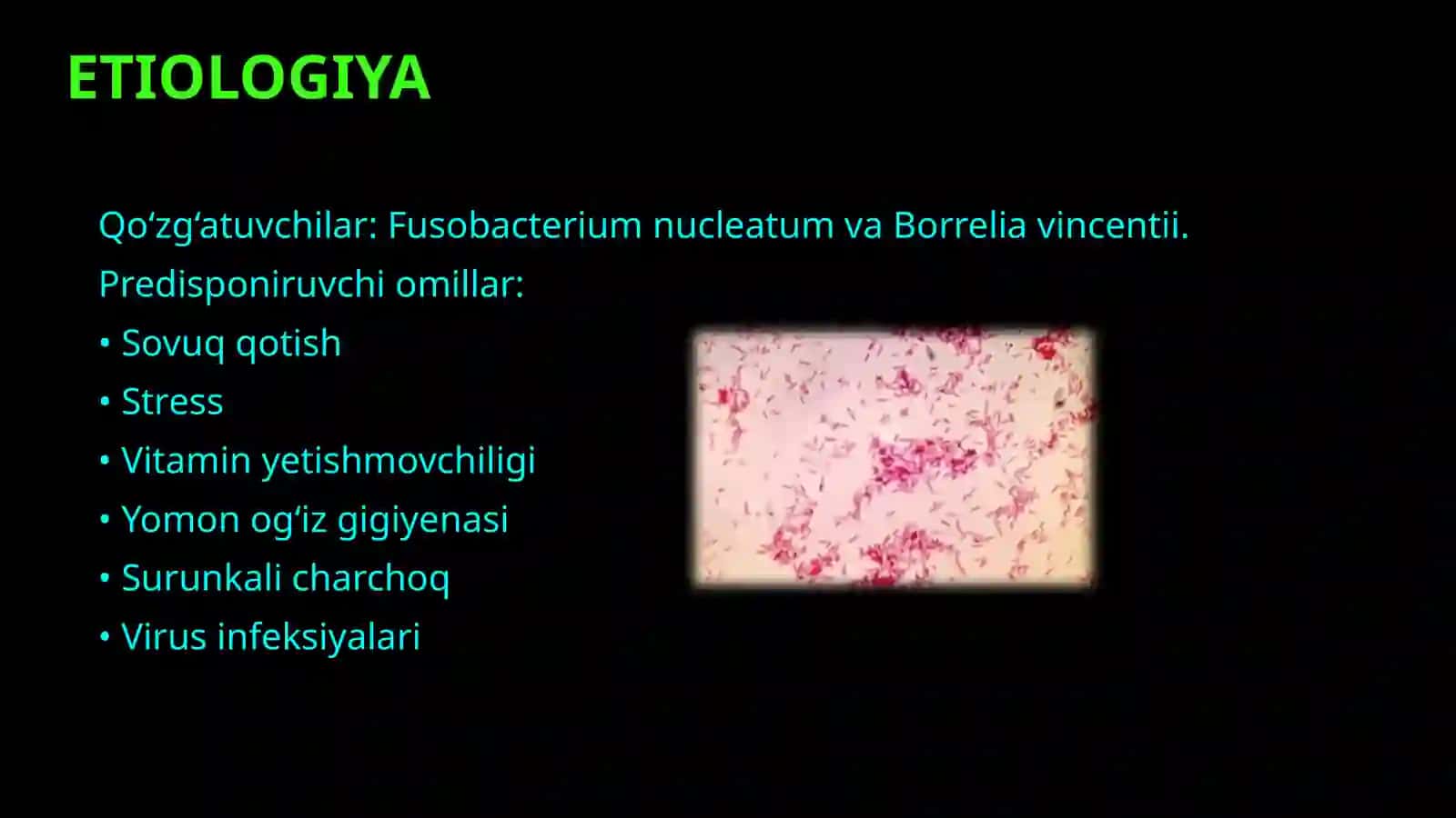 Yarali-nekrotik stomatit Vensan. Klinika. Davolash. 4