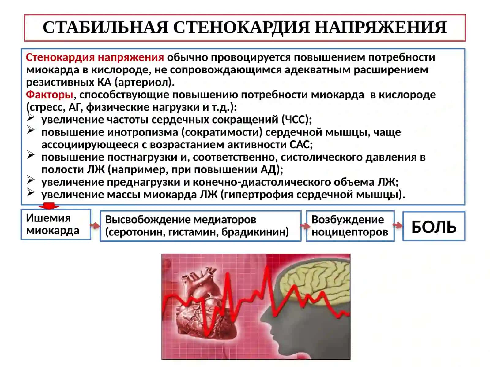 Ишемическая болезнь сердца 4