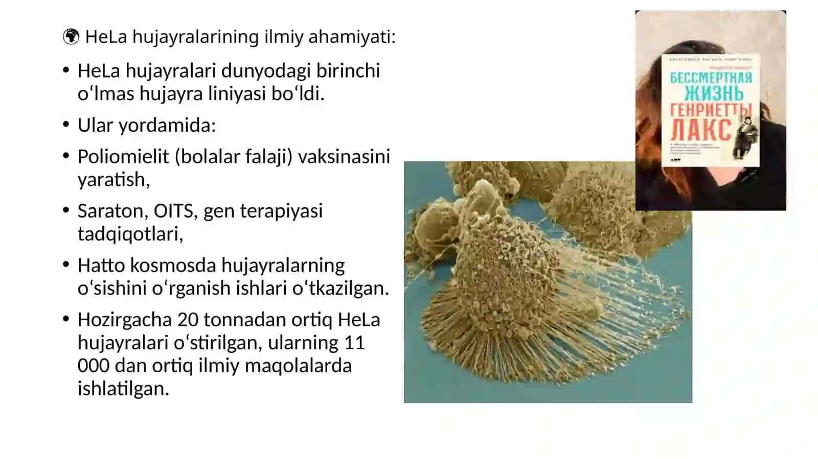 O`smalar. Epitelial o`smalar 4