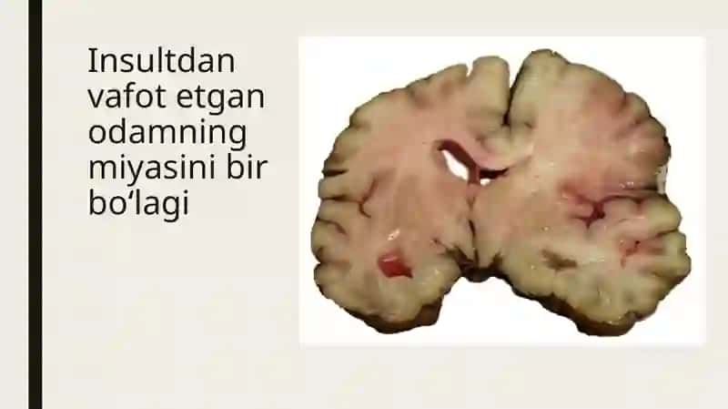 insult ppt 4