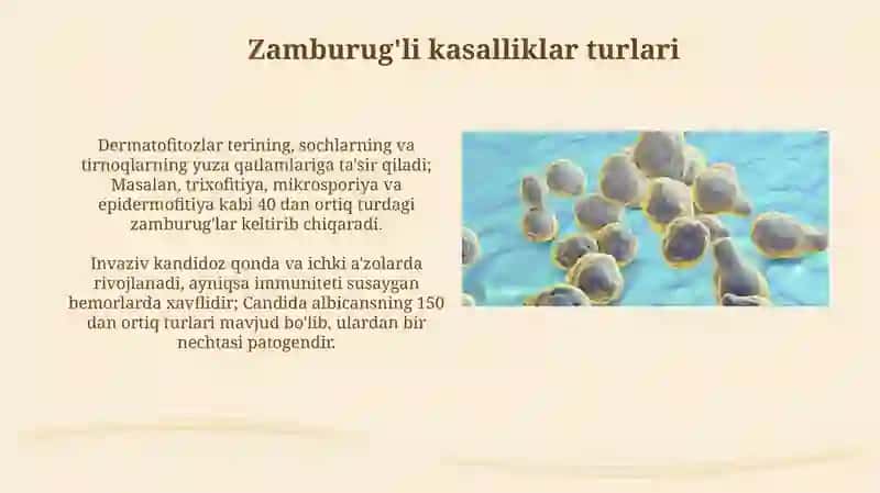 Zamburug'li kasalliklar: turlari, belgilari va tarqalish yo'llari 4
