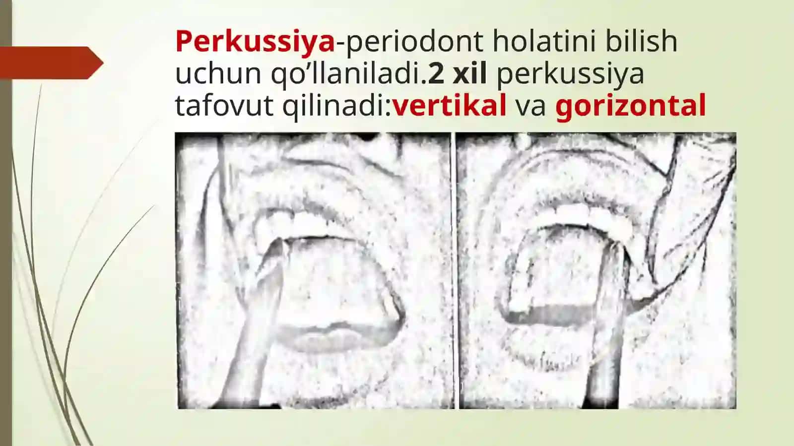 Bolalarda og'iz bo'shlig'ining profilaktik ko'rigini o'tkazish 4