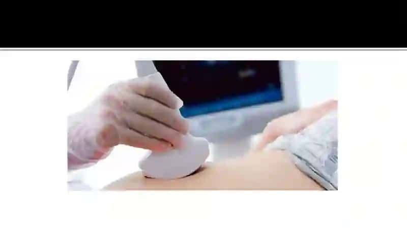 Ултратовуштекширувусули 4