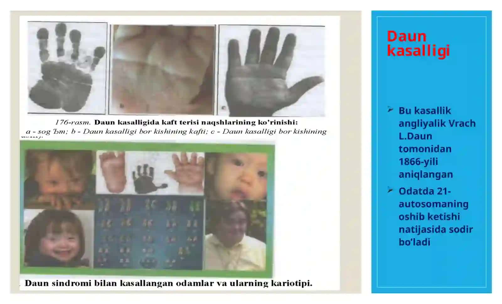 irsiy kasalliklar 4