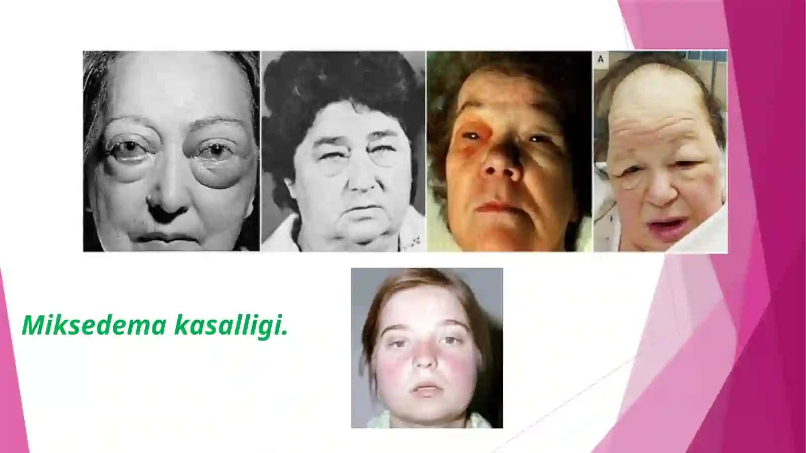 Sekret bezlariga to‘g‘risida tushuncha 4