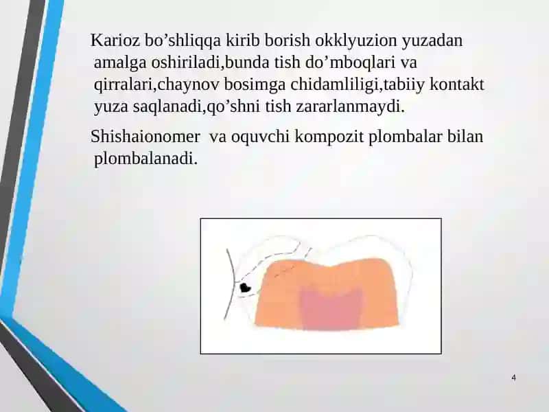 Tunnellicharxlash usuli 4