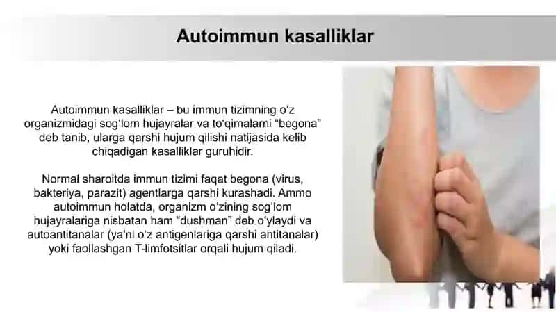 Immunologik tolerantImmunologik tolerantlik nuqsonlari. Autoimmun xastaliklar. Psevdoallergiya. Atopikkasalliklar haqida tushuncha, dori va ozuqaviy allergiyalik nuqsonlari 4