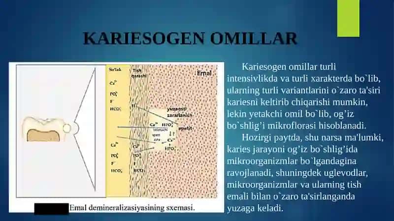 Tish Kariesi 4