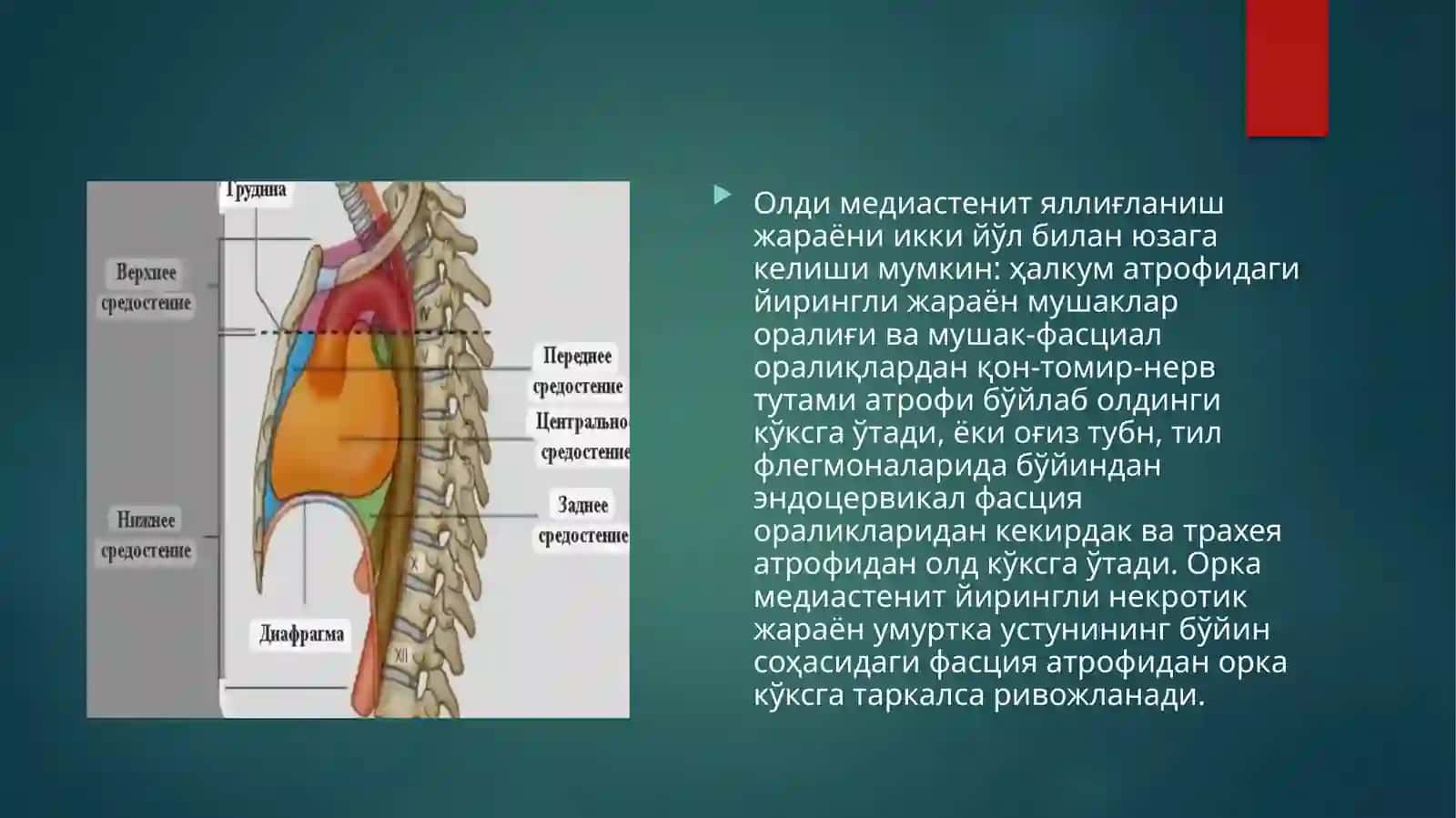 Медиастенит 4