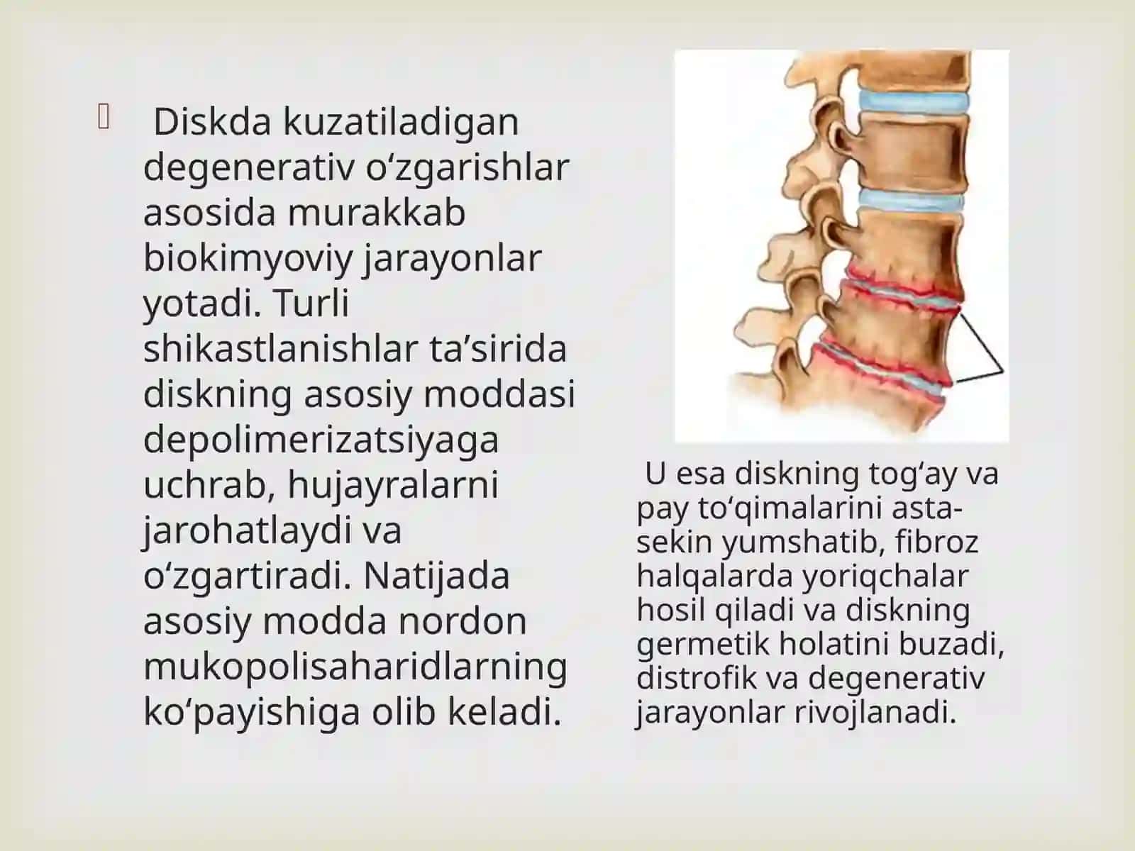 Osteoxondroz 4