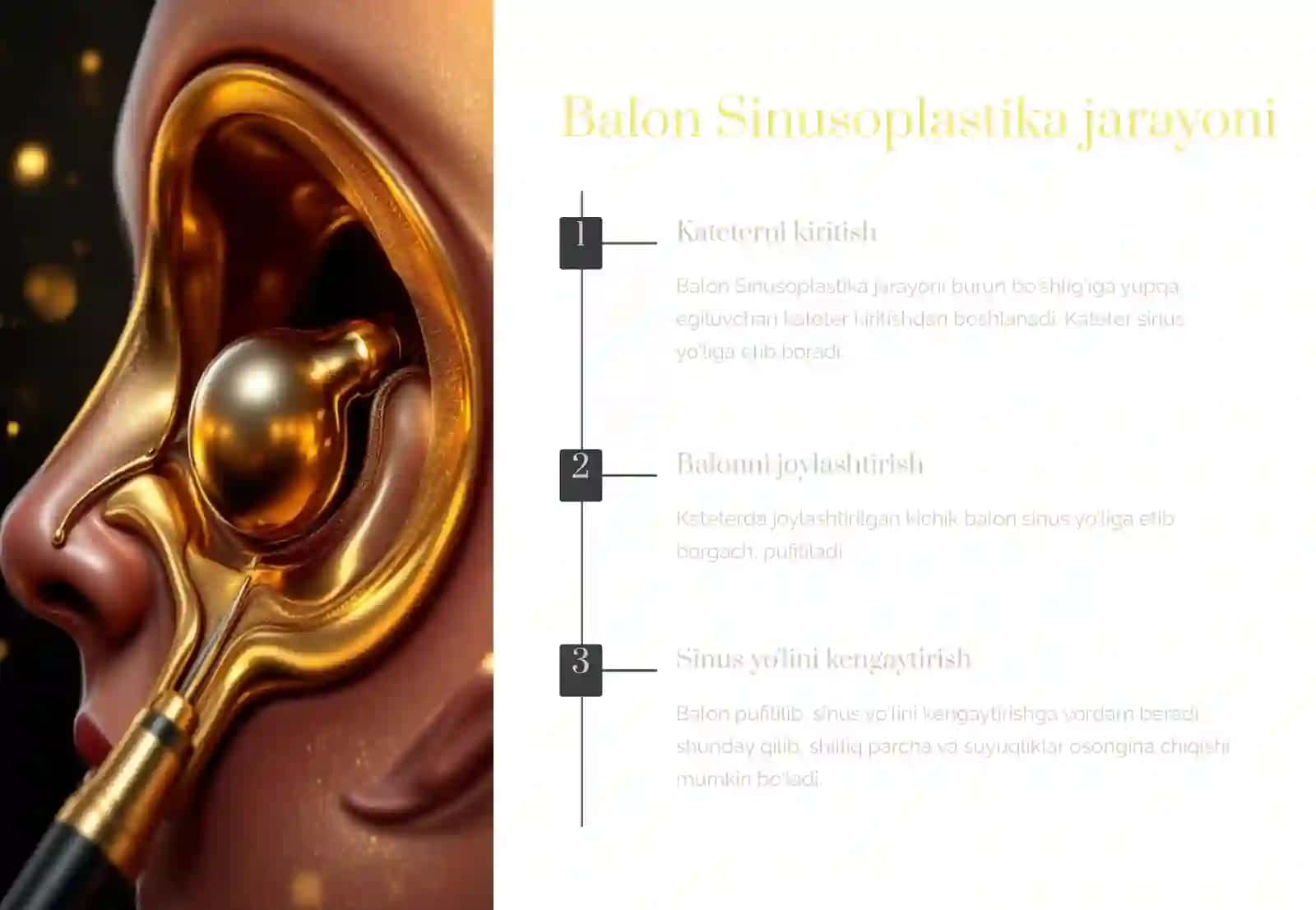 Balonasinusoplastika 4