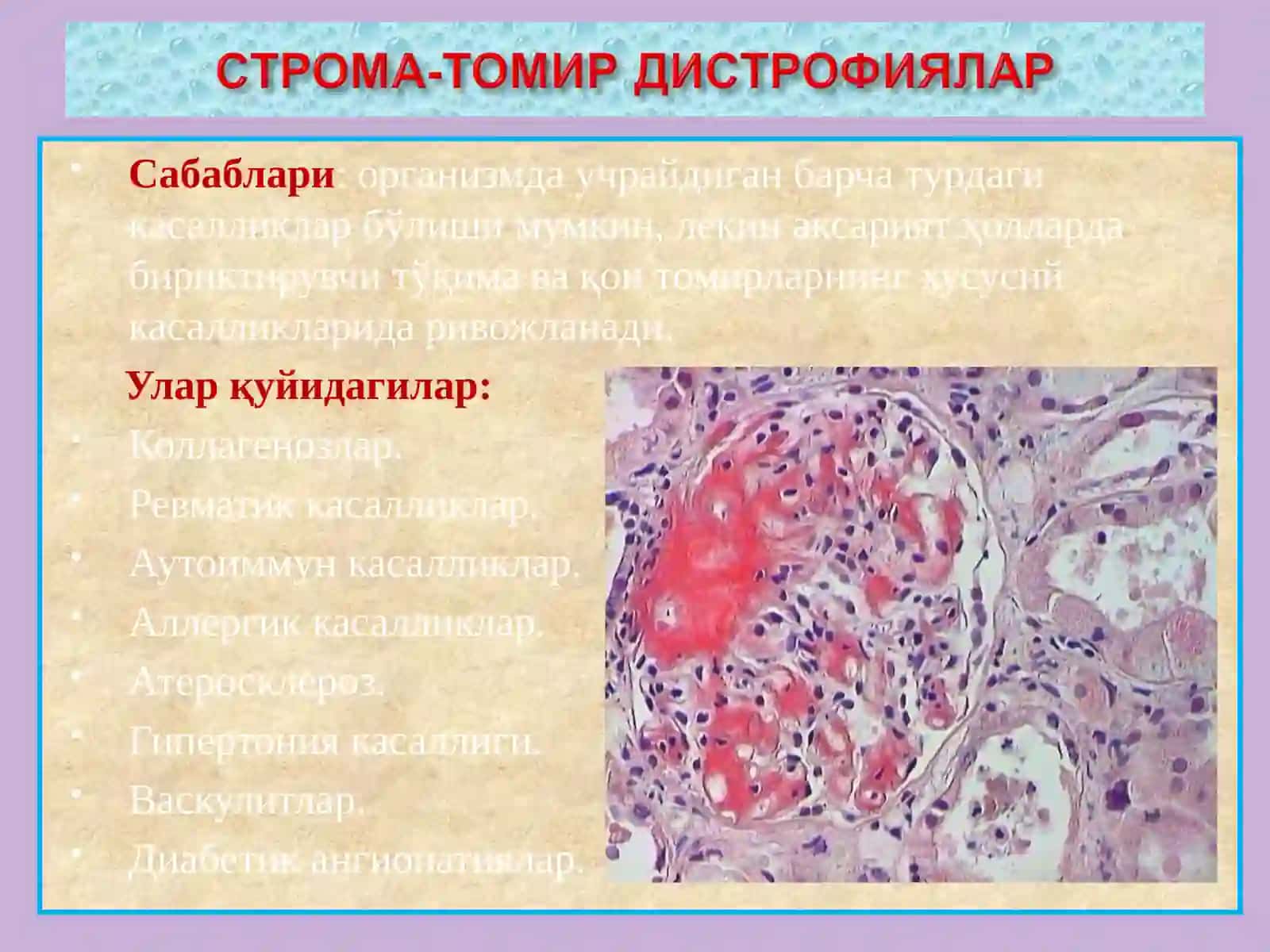СТРОМАЛ – ТОМИРЛИ ДИСТРОФИЯЛАР 4