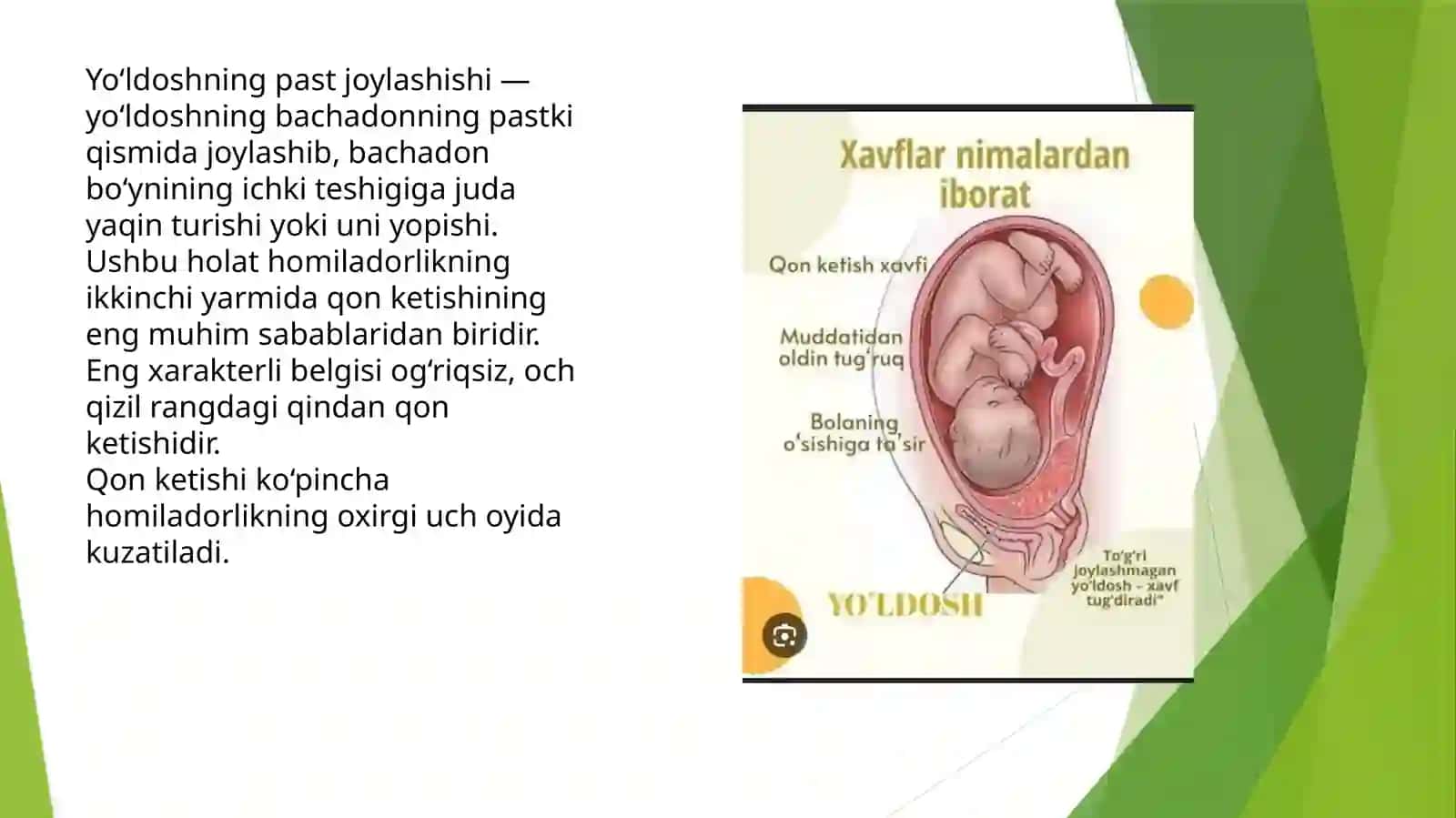 Homiladorlikning ikkinchi yarimida qon ketishining asosiy sabablari 4