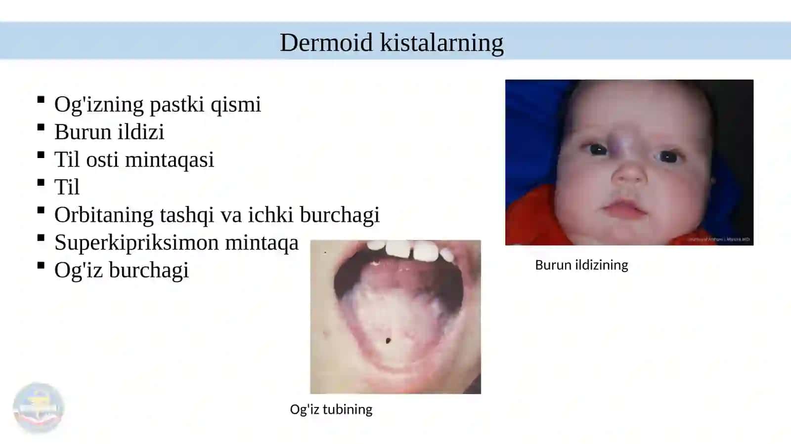 Tug‘ma kistalar (Epidermoid va dermoid) 4