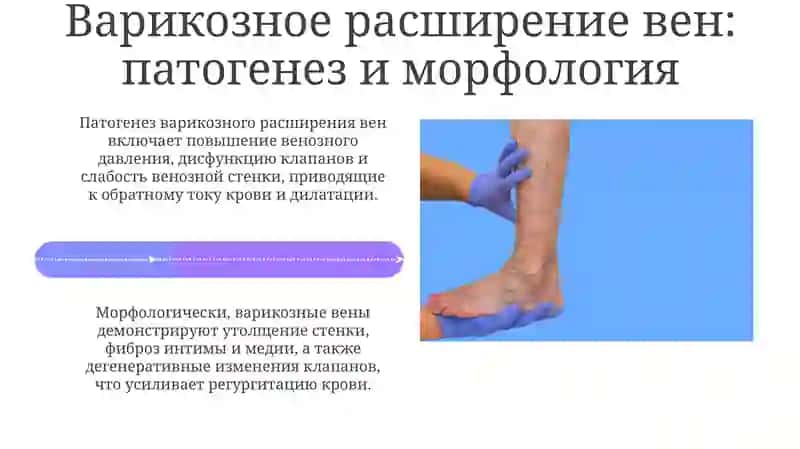 Патология вен и лимфатических сосудов 4
